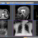 Sante DICOM Viewer Pro screenshot