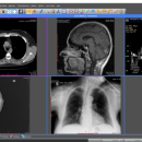 Sante DICOM Editor screenshot